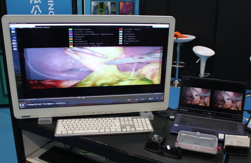 On display at Smart Surgery Technology was an AI-based solution for 3D surgical...