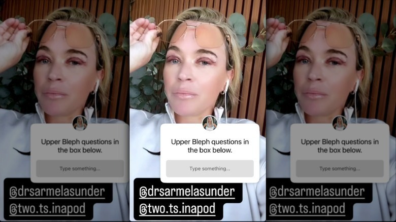 Teddi Mellencamp asking for questions about her upper blepharoplasty on her Instagram Story